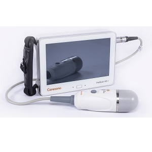 BLADDER SCANNER CARESONO HD3